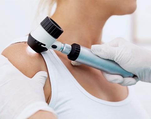 dermatologische-untersuchung-muttermal dermatologische-untersuchung-muttermal